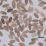 Light to dark brown, elliptic, unicellular to single septate conidia produced by Diplodia sapinea (Scale bar = 30 µm). Photo by N. Brazee