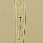 The head region of a dagger nematode. Note the long, slender stylet.