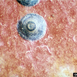 Figure 1) Close up of adult female San Jose scale showing circular grey scale