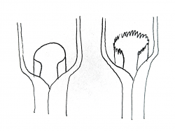 The ligule is a membranous sheath that wraps around the stem at the collar region.