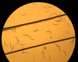 A microscopy picture of many nematodes in solution.